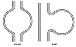 紡錘状瘤と嚢状瘤